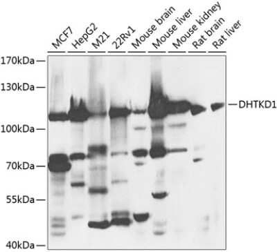 Western Blot: DHTKD1 AntibodyBSA Free [NBP2-92540]