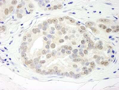 Immunohistochemistry: DHX15 Antibody [NB100-585]