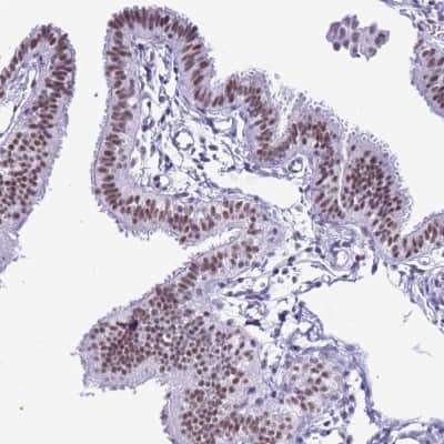 Immunohistochemistry-Paraffin: DHX15 Antibody [NBP2-13919]