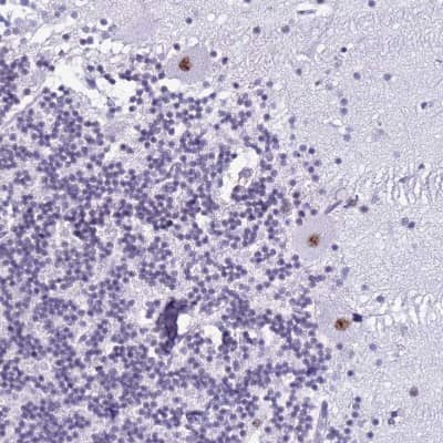 Immunohistochemistry-Paraffin: DHX15 Antibody [NBP2-13919]