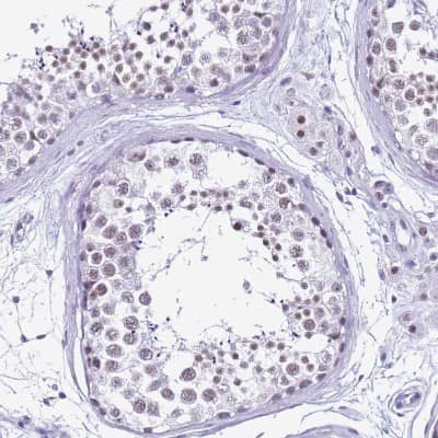 Immunohistochemistry-Paraffin: DHX15 Antibody [NBP2-13919]