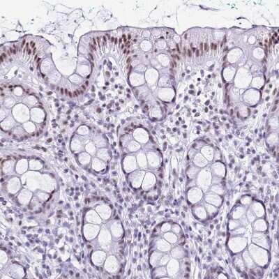 Immunohistochemistry-Paraffin: DHX15 Antibody [NBP2-13919]