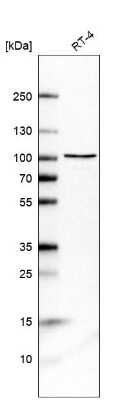 Western Blot: DHX15 Antibody [NBP2-13919]