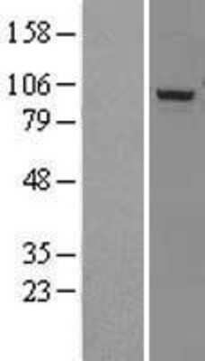 Western Blot: DHX15 Overexpression Lysate [NBL1-09876]