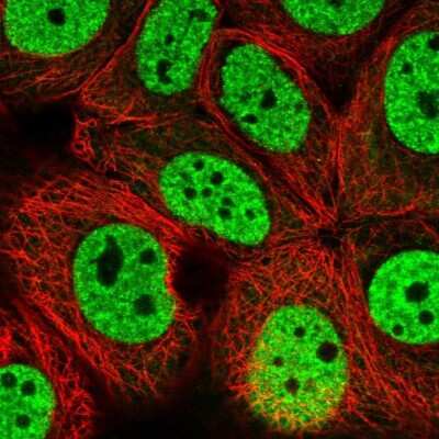 Immunocytochemistry/ Immunofluorescence: DHX16 Antibody [NBP2-13920]