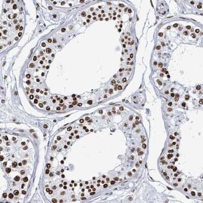 Immunohistochemistry-Paraffin: DHX16 Antibody [NBP2-13920]