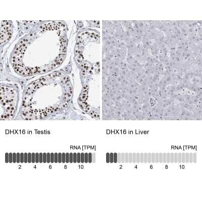 Immunohistochemistry-Paraffin: DHX16 Antibody [NBP2-13920]