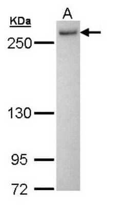 Western Blot: DHX16 Antibody [NBP1-31067]