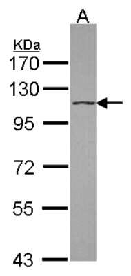 Western Blot: DHX16 Antibody [NBP2-16161]