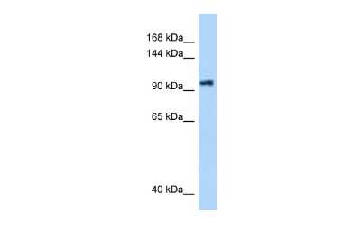 Western Blot: DHX16 Antibody [NBP2-87270]