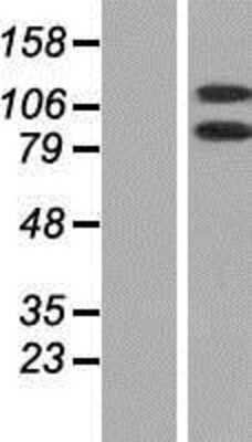 Western Blot: DHX16 Overexpression Lysate [NBP2-07977]