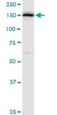 Western Blot: DHX29 Antibody [H00054505-B01P]