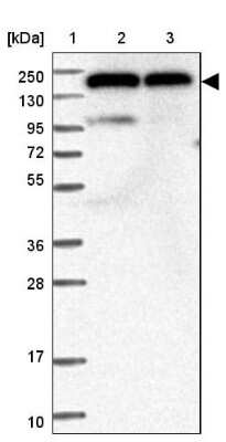 Western Blot: DHX29 Antibody [NBP1-85272]