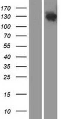 Western Blot: DHX29 Overexpression Lysate [NBP2-06734]