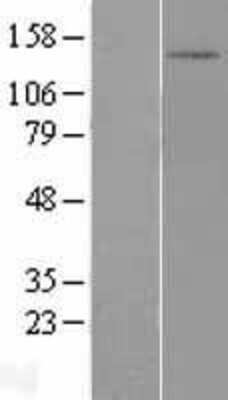 Western Blot: DHX30 Overexpression Lysate [NBL1-09879]