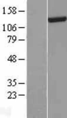 Western Blot: DHX30 Overexpression Lysate [NBL1-09880]