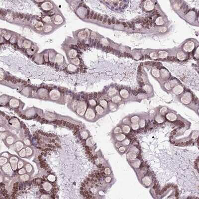 Immunohistochemistry-Paraffin: DHX32 Antibody [NBP2-13921]