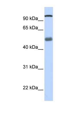 Western Blot: DHX32 Antibody [NBP1-57347]