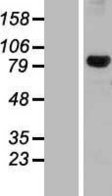 Western Blot: DHX32 Overexpression Lysate [NBL1-09881]