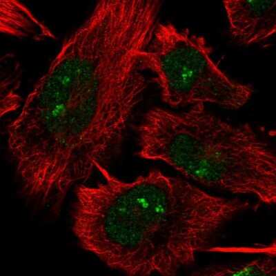 Immunocytochemistry/ Immunofluorescence: DHX33 Antibody [NBP2-56501]