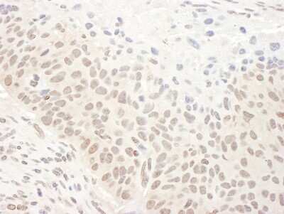 Immunohistochemistry: DHX33 Antibody [NB100-2580]