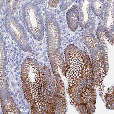 Immunohistochemistry-Paraffin: DHX34 Antibody [NBP1-91832]