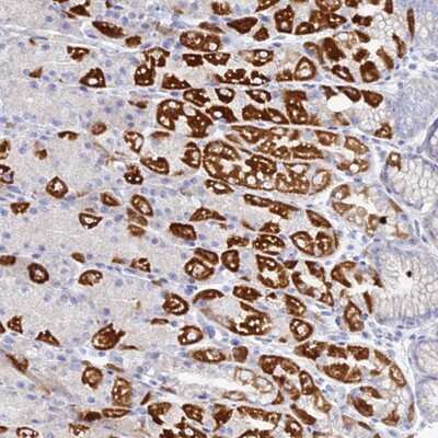 Immunohistochemistry-Paraffin: DHX34 Antibody [NBP1-91833]