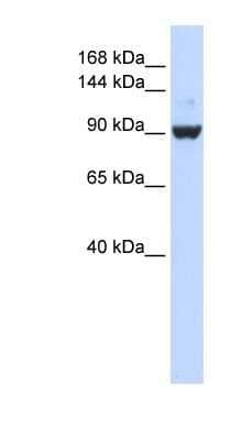 Western Blot: DHX34 Antibody [NBP1-57294]