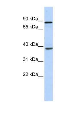 Western Blot: DHX35 Antibody [NBP1-57348]