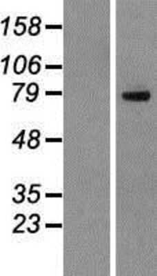 Western Blot: DHX35 Overexpression Lysate [NBP2-06510]