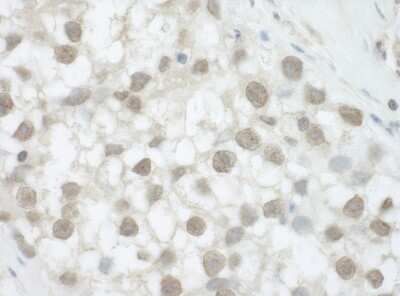 Immunohistochemistry: DHX36 Antibody [NB200-353]