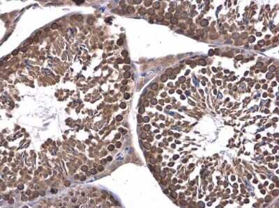 Immunohistochemistry-Paraffin: DHX36 Antibody [NBP3-12999]