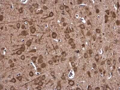 Immunohistochemistry-Paraffin: DHX36 Antibody [NBP3-12999]