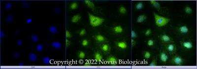 Immunocytochemistry/ Immunofluorescence: DHX37 Antibody [NBP3-18056]
