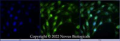 Immunocytochemistry/ Immunofluorescence: DHX37 Antibody [NBP3-18056]