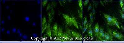 Immunocytochemistry/ Immunofluorescence: DHX37 Antibody [NBP3-18056]