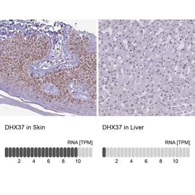 Immunohistochemistry-Paraffin: DHX37 Antibody [NBP2-13922]