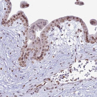 Immunohistochemistry-Paraffin: DHX37 Antibody [NBP2-13922]