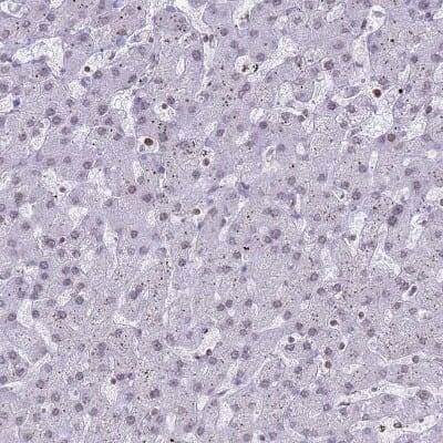 Immunohistochemistry-Paraffin: DHX37 Antibody [NBP2-13922]