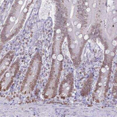Immunohistochemistry-Paraffin: DHX37 Antibody [NBP2-13922]