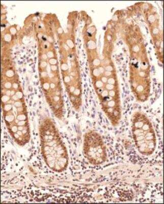 Immunohistochemistry-Paraffin: DHX37 Antibody [NBP3-18056]