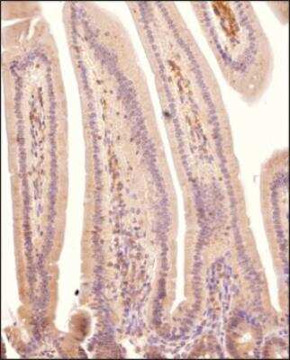 Immunohistochemistry-Paraffin: DHX37 Antibody [NBP3-18056]