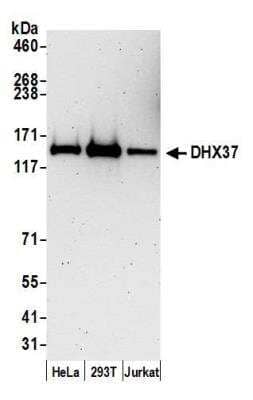 Western Blot: DHX37 Antibody [NB110-40580]