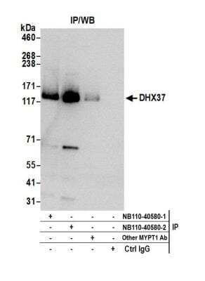 Western Blot: DHX37 Antibody [NB110-40580]