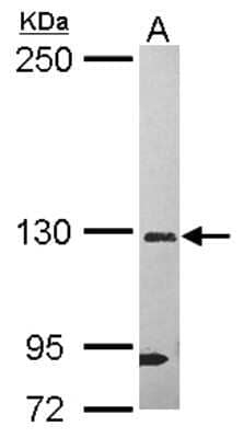 Western Blot: DHX37 Antibody [NBP2-16162]