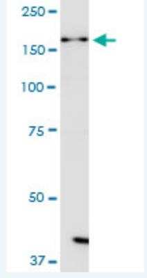Western Blot: DHX38 Antibody (3B9) [H00009785-M02-100ug]