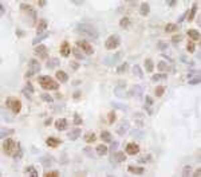 Immunohistochemistry-Paraffin: DHX38 Antibody [NB110-40582]
