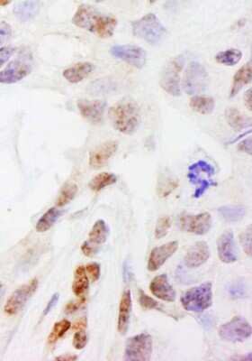 Immunohistochemistry-Paraffin: DHX38 Antibody [NB110-40582]