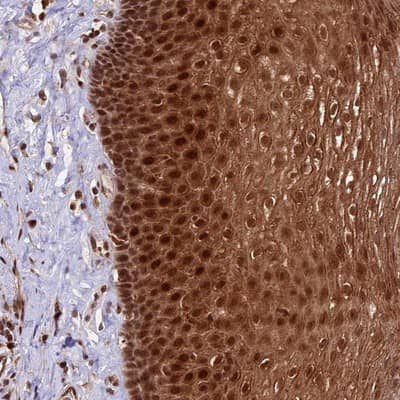 Immunohistochemistry-Paraffin: DHX38 Antibody [NBP1-85269]