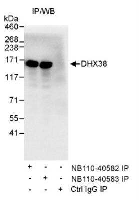 Immunoprecipitation: DHX38 Antibody [NB110-40582]